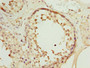 Immunohistochemistry of paraffin-embedded human testis tissue using CAC14317 at dilution of 1:100 Immunohistochemistry of paraffin-embedded human testis tissue using CAC14317 at dilution of 1:100