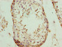 Immunohistochemistry of paraffin-embedded human testis tissue using CAC14326 at dilution of 1:100 Immunohistochemistry of paraffin-embedded human testis tissue using CAC14326 at dilution of 1:100