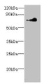 Western Blot, All lanes: NEK11 antibody at 7ug/ml + Hela whole cell lysate, Secondary, Goat polyclonal to rabbit at 1/10000 dilution, Predicted band size: 75, 55, 56, 69 kDa, Observed band size: 75 kDa Western Blot, All lanes: NEK11 antibody at 7ug/ml + Hela whole cell lysate, Secondary, Goat polyclonal to rabbit at 1/10000 dilution, Predicted band size: 75, 55, 56, 69 kDa, Observed band size: 75 kDa
