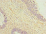 Immunohistochemistry of paraffin-embedded human ovarian cancer using CAC14342 at dilution of 1:100