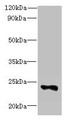 Western Blot, All lanes: FAM156A antibody at 5ug/ml + Mouse heart tissue, Secondary, Goat polyclonal to rabbit IgG at 1/10000 dilution, Predicted band size: 25 kDa, Observed band size: 25 kDa