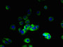 Immunofluorescent analysis of MCF-7 cells using CAC14346 at dilution of 1:100 and Alexa Fluor 488-congugated AffiniPure Goat Anti-Rabbit IgG(H+L) Immunofluorescent analysis of MCF-7 cells using CAC14346 at dilution of 1:100 and Alexa Fluor 488-congugated AffiniPure Goat Anti-Rabbit IgG(H+L)
