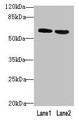Western Blot, All lanes: BTN2A2 antibody at 10ug/ml, Lane 1: MCF-7 whole cell lysate, Lane 2: NIH/3T3 whole cell lysate, Secondary, Goat polyclonal to rabbit IgG at 1/10000 dilution, Predicted band size: 60, 38, 29, 46, 36 kDa, Observed band size: 60 kDa Western Blot, All lanes: BTN2A2 antibody at 10ug/ml, Lane 1: MCF-7 whole cell lysate, Lane 2: NIH/3T3 whole cell lysate, Secondary, Goat polyclonal to rabbit IgG at 1/10000 dilution, Predicted band size: 60, 38, 29, 46, 36 kDa, Observed band size: 60 kDa
