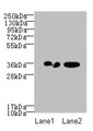 Western Blot, All lanes: RPRD1A antibody at 2ug/ml, Lane 1: A431 whole cell lysate, Lane 2: Jurkat whole cell lysate, Secondary, Goat polyclonal to Rabbit IgG at 1/10000 dilution, Predicted band size: 36, 32 kDa, Observed band size: 36 kDa Western Blot, All lanes: RPRD1A antibody at 2ug/ml, Lane 1: A431 whole cell lysate, Lane 2: Jurkat whole cell lysate, Secondary, Goat polyclonal to Rabbit IgG at 1/10000 dilution, Predicted band size: 36, 32 kDa, Observed band size: 36 kDa