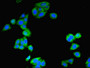 Immunofluorescent analysis of HepG2 cells using CAC14357 at dilution of 1:100 and Alexa Fluor 488-congugated AffiniPure Goat Anti-Rabbit IgG(H+L) Immunofluorescent analysis of HepG2 cells using CAC14357 at dilution of 1:100 and Alexa Fluor 488-congugated AffiniPure Goat Anti-Rabbit IgG(H+L)