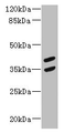 Western Blot, All lanes: MAGEB10 antibody at 12ug/ml + Mouse heart tissue, Secondary, Goat polyclonal to rabbit IgG at 1/10000 dilution, Predicted band size: 39 kDa, Observed band size: 39, 35 kDa Western Blot, All lanes: MAGEB10 antibody at 12ug/ml + Mouse heart tissue, Secondary, Goat polyclonal to rabbit IgG at 1/10000 dilution, Predicted band size: 39 kDa, Observed band size: 39, 35 kDa