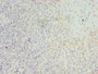 Immunohistochemistry of paraffin-embedded human tonsil tissue using CAC14364 at dilution of 1:100 Immunohistochemistry of paraffin-embedded human tonsil tissue using CAC14364 at dilution of 1:100