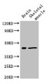 Western Blot, Positive WB detected in: Mouse brain tissue, Mouse skeletal muscle tissue, All lanes: FAM43A antibody at 3ug/ml, Secondary, Goat polyclonal to rabbit IgG at 1/50000 dilution, Predicted band size: 46 kDa, Observed band size: 46 kDa