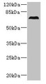 Western Blot, All lanes: CEP76 antibody at 0.5ug/ml + 293T whole cell lysate, Secondary, Goat polyclonal to rabbit IgG at 1/10000 dilution, Predicted band size: 75, 66, 30 kDa, Observed band size: 75 kDa Western Blot, All lanes: CEP76 antibody at 0.5ug/ml + 293T whole cell lysate, Secondary, Goat polyclonal to rabbit IgG at 1/10000 dilution, Predicted band size: 75, 66, 30 kDa, Observed band size: 75 kDa
