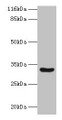 Western Blot, All lanes: MAIP1 antibody at 2ug/ml + Mouse kidney tissue, Secondary, Goat polyclonal to rabbit IgG at 1/10000 dilution, Predicted band size: 33 kDa, Observed band size: 33 kDa Western Blot, All lanes: MAIP1 antibody at 2ug/ml + Mouse kidney tissue, Secondary, Goat polyclonal to rabbit IgG at 1/10000 dilution, Predicted band size: 33 kDa, Observed band size: 33 kDa