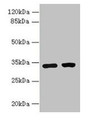 Western Blot, All lanes: C3orf49 antibody at 5ug/ml, Lane 1: U251 whole cell lysate, Lane 2: MCF-7 whole cell lysate, Secondary, Goat polyclonal to rabbit IgG at 1/10000 dilution, Predicted band size: 34 kDa, Observed band size: 34 kDa