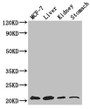 Western Blot, Positive WB detected in: MCF-7 whole cell lysate, Mouse liver tissue, Mouse kidney tissue, Mouse stomach tissue, All lanes: GNPNAT1 antibody at 3.4ug/ml, Secondary, Goat polyclonal to rabbit IgG at 1/50000 dilution, Predicted band size: 21 kDa, Observed band size: 21 kDa