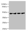 Western Blot, All lanes: PRMT6 antibody at 0.4ug/ml, Lane 1: 293T whole cell lysate, Lane 2: MCF-7 whole cell lysate, Lane 3: A431 whole cell lysate, Lane 4: K562 whole cell lysate, Secondary, Goat polyclonal to rabbit IgG at 1/10000 dilution, Predicted band size: 42, 33 kDa, Observed band size: 42 kDa