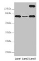 Western Blot, All lanes: TTC12 antibody at 8ug/ml, Lane 1: Mouse large intestine tissue, Lane 2: Mouse small intestine tissue, Lane 3: HepG2 whole cell lysate, Secondary, Goat polyclonal to rabbit IgG at 1/10000 dilution, Predicted band size: 79, 82 kDa, Observed band size: 79, 170 kDa Western Blot, All lanes: TTC12 antibody at 8ug/ml, Lane 1: Mouse large intestine tissue, Lane 2: Mouse small intestine tissue, Lane 3: HepG2 whole cell lysate, Secondary, Goat polyclonal to rabbit IgG at 1/10000 dilution, Predicted band size: 79, 82 kDa, Observed band size: 79, 170 kDa