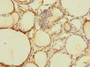 Immunohistochemistry of paraffin-embedded human thyroid tissue using CAC14389 at dilution of 1:100 Immunohistochemistry of paraffin-embedded human thyroid tissue using CAC14389 at dilution of 1:100