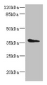 Western Blot, All lanes: AASDHPPT antibody at 2ug/ml + HepG2 whole cell lysate, Secondary, Goat polyclonal to rabbit IgG at 1/10000 dilution, Predicted band size: 36, 16 kDa, Observed band size: 36 kDa Western Blot, All lanes: AASDHPPT antibody at 2ug/ml + HepG2 whole cell lysate, Secondary, Goat polyclonal to rabbit IgG at 1/10000 dilution, Predicted band size: 36, 16 kDa, Observed band size: 36 kDa