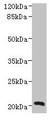 Western Blot, All lanes: NICN1 antibody at 4ug/ml + U937 whole cell lysate, Secondary, Goat polyclonal to rabbit IgG at 1/10000 dilution, Predicted band size: 25, 20 kDa, Observed band size: 20 kDa Western Blot, All lanes: NICN1 antibody at 4ug/ml + U937 whole cell lysate, Secondary, Goat polyclonal to rabbit IgG at 1/10000 dilution, Predicted band size: 25, 20 kDa, Observed band size: 20 kDa