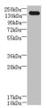 Western Blot, All lanes: UBE2O antibody at 0.8ug/ml + A431 whole cell lysate, Secondary, Goat polyclonal to rabbit IgG at 1/10000 dilution, Predicted band size: 142 kDa, Observed band size: 142 kDa Western Blot, All lanes: UBE2O antibody at 0.8ug/ml + A431 whole cell lysate, Secondary, Goat polyclonal to rabbit IgG at 1/10000 dilution, Predicted band size: 142 kDa, Observed band size: 142 kDa