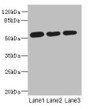Western Blot, All lanes: ARMT1 antibody at 0.6ug/ml, Lane 1: MCF-7 whole cell lysate, Lane 2: A431 whole cell lysate, Lane 3: 293T whole cell lysate, Secondary, Goat polyclonal to rabbit IgG at 1/10000 dilution, Predicted band size: 52 kDa, Observed band size: 52 kDa Western Blot, All lanes: ARMT1 antibody at 0.6ug/ml, Lane 1: MCF-7 whole cell lysate, Lane 2: A431 whole cell lysate, Lane 3: 293T whole cell lysate, Secondary, Goat polyclonal to rabbit IgG at 1/10000 dilution, Predicted band size: 52 kDa, Observed band size: 52 kDa