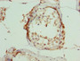 Immunohistochemistry of paraffin-embedded human testis tissue using CAC14411 at dilution of 1:100 Immunohistochemistry of paraffin-embedded human testis tissue using CAC14411 at dilution of 1:100