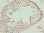 Immunohistochemistry of paraffin-embedded human testis tissue using CAC14420 at dilution of 1:100 Immunohistochemistry of paraffin-embedded human testis tissue using CAC14420 at dilution of 1:100