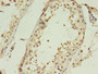 Immunohistochemistry of paraffin-embedded human testis tissue using CAC14431 at dilution of 1:100 Immunohistochemistry of paraffin-embedded human testis tissue using CAC14431 at dilution of 1:100