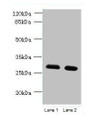 Western Blot, All lanes: TMEM38B antibody at 1.5ug/ml, Lane 1: Mouse thymus tissue, Lane 2: Mouse liver tissue, Secondary, Goat polyclonal to rabbit IgG at 1/10000 dilution, Predicted band size: 33 kDa, Observed band size: 33 kDa Western Blot, All lanes: TMEM38B antibody at 1.5ug/ml, Lane 1: Mouse thymus tissue, Lane 2: Mouse liver tissue, Secondary, Goat polyclonal to rabbit IgG at 1/10000 dilution, Predicted band size: 33 kDa, Observed band size: 33 kDa