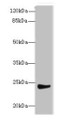 Western Blot, All lanes: MRPL22 antibody at 12ug/ml + SH-SY5Y whole cell lysate, Secondary, Goat polyclonal to rabbit IgG at 1/10000 dilution, Predicted band size: 24, 14, 15 kDa, Observed band size: 24 kDa