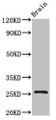 Western Blot, Positive WB detected in: Mouse brain tissue, All lanes: BTG4 antibody at 3ug/ml, Secondary, Goat polyclonal to rabbit IgG at 1/50000 dilution, Predicted band size: 26, 25 kDa, Observed band size: 26 kDa