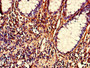 Immunohistochemistry of paraffin-embedded human colon cancer using CAC14447 at dilution of 1:100