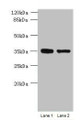 Western Blot, All lanes: MGME1 antibody at 1ug/ml, Lane 1: Jurkat whole cell lysate, Lane 2: 293T whole cell lysate, Secondary, Goat polyclonal to rabbit IgG at 1/10000 dilution, Predicted band size: 39 kDa, Observed band size: 39 kDa Western Blot, All lanes: MGME1 antibody at 1ug/ml, Lane 1: Jurkat whole cell lysate, Lane 2: 293T whole cell lysate, Secondary, Goat polyclonal to rabbit IgG at 1/10000 dilution, Predicted band size: 39 kDa, Observed band size: 39 kDa