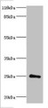 Western Blot, All lanes: Protein DGCR6L antibody at 2ug/ml + Mouse brain tissue, Secondary, Goat polyclonal to rabbit IgG at 1/10000 dilution, Predicted band size: 25 kDa, Observed band size: 25 kDa Western Blot, All lanes: Protein DGCR6L antibody at 2ug/ml + Mouse brain tissue, Secondary, Goat polyclonal to rabbit IgG at 1/10000 dilution, Predicted band size: 25 kDa, Observed band size: 25 kDa