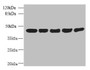 Western Blot, All lanes: ACTRT3 antibody at 2.5ug/ml, Lane 1: MCF-7 whole cell lysate, Lane 2: HCT116 whole cell lysate, Lane 3: K562 whole cell lysate, Lane 4: 293T whole cell lysate, Lane 5: Hela whole cell lysate, Secondary, Goat polyclonal to rabbit IgG at 1/10000 dilution, Predicted band size: 42 kDa, Observed band size: 42 kDa Western Blot, All lanes: ACTRT3 antibody at 2.5ug/ml, Lane 1: MCF-7 whole cell lysate, Lane 2: HCT116 whole cell lysate, Lane 3: K562 whole cell lysate, Lane 4: 293T whole cell lysate, Lane 5: Hela whole cell lysate, Secondary, Goat polyclonal to rabbit IgG at 1/10000 dilution, Predicted band size: 42 kDa, Observed band size: 42 kDa