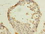 Immunohistochemistry of paraffin-embedded human testis tissue using CAC14450 at dilution of 1:100 Immunohistochemistry of paraffin-embedded human testis tissue using CAC14450 at dilution of 1:100