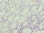 Immunohistochemistry of paraffin-embedded human stomach tissue using CAC14451 at dilution of 1:100 Immunohistochemistry of paraffin-embedded human stomach tissue using CAC14451 at dilution of 1:100