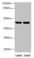 Western Blot, All lanes: NIF3L1 antibody at 0.2ug/ml, Lane 1: 293T whole cell lysate, Lane 2: MDA-MB-231 whole cell lysate, Secondary, Goat polyclonal to rabbit IgG at 1/10000 dilution, Predicted band size: 42, 39, 33 kDa, Observed band size: 42 kDa Western Blot, All lanes: NIF3L1 antibody at 0.2ug/ml, Lane 1: 293T whole cell lysate, Lane 2: MDA-MB-231 whole cell lysate, Secondary, Goat polyclonal to rabbit IgG at 1/10000 dilution, Predicted band size: 42, 39, 33 kDa, Observed band size: 42 kDa