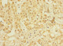 Immunohistochemistry of paraffin-embedded human adrenal gland tissue using CAC14452 at dilution of 1:100 Immunohistochemistry of paraffin-embedded human adrenal gland tissue using CAC14452 at dilution of 1:100