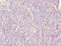 Immunohistochemistry of paraffin-embedded human thymus tissue using CAC14453 at dilution of 1:100 Immunohistochemistry of paraffin-embedded human thymus tissue using CAC14453 at dilution of 1:100