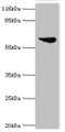 Western Blot, All lanes: Set1/Ash2 histone methyltransferase complex subunit ASH2 antibody at 2ug/ml + K562 whole cell lysate, Secondary, Goat polyclonal to rabbit IgG at 1/10000 dilution, Predicted band size: 69, 57, 61 kDa, Observed band size: 69 kDa