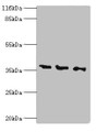 Western Blot, All lanes: N-acetyl-D-glucosamine kinase antibody at 2ug/ml, Lane 1: HepG2 whole cell lysate, Lane 2: 293T whole cell lysate, Lane 3: Hela whole cell lysate, Secondary, Goat polyclonal to rabbit IgG at 1/10000 dilution, Predicted band size: 38, 43 kDa, Observed band size: 38 kDa