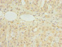 Immunohistochemistry of paraffin-embedded human adrenal gland tissue using CAC14464 at dilution of 1:100