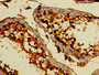 Immunohistochemistry of paraffin-embedded human testis tissue using CAC14471 at dilution of 1:100
