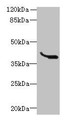 Western Blot, All lanes: LRTM1 antibody at 0.4ug/ml + K562 whole cell lysate, Secondary, Goat polyclonal to rabbit IgG at 1/10000 dilution, Predicted band size: 39, 30 kDa, Observed band size: 39 kDa