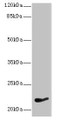 Western Blot, All lanes: NKIRAS1 antibody at 7ug/ml + HepG2 whole cell lysate, Secondary, Goat polyclonal to rabbit IgG at 1/10000 dilution, Predicted band size: 22 kDa, Observed band size: 22 kDa