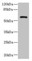 Western Blot, All lanes: ZCCHC4 antibody at 0.6ug/ml + A431 whole cell lysate, Secondary, Goat polyclonal to rabbit IgG at 1/10000 dilution, Predicted band size: 60, 26, 59 kDa, Observed band size: 60 kDa