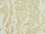 Immunohistochemistry of paraffin-embedded human heart tissue using CAC14490 at dilution of 1:100