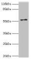 Western Blot, All lanes: RAD18 antibody at 2ug/ml + COLO205 whole cell lysate, Secondary, Goat polyclonal to rabbit IgG at 1/10000 dilution, Predicted band size: 57 kDa, Observed band size: 57 kDa