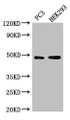 Western Blot, Positive WB detected in: PC-3 whole cell lysate, HEK293 whole cell lysate, All lanes: ACTR10 antibody at 3ug/ml, Secondary, Goat polyclonal to rabbit IgG at 1/50000 dilution, Predicted band size: 47 kDa, Observed band size: 47 kDa