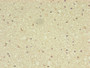 Immunohistochemistry of paraffin-embedded human brain tissue using CAC14501 at dilution of 1:100