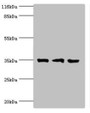 Western Blot, All lanes: Rab effector Noc2 antibody at 2ug/ml, Lane 1: Rat liver tissue, Lane 2: K562 whole cell lysate, Lane 3: A549 whole cell lysate, Secondary, Goat polyclonal to rabbit IgG at 1/10000 dilution, Predicted band size: 35, 32 kDa, Observed band size: 35 kDa